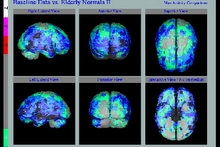 Brain CBF Scan WS.jpg